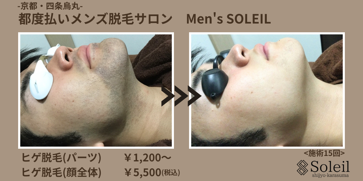 京都で髭脱毛ならメンズソレイユへ